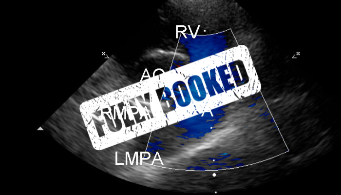 Advanced Echocardiography Workshop