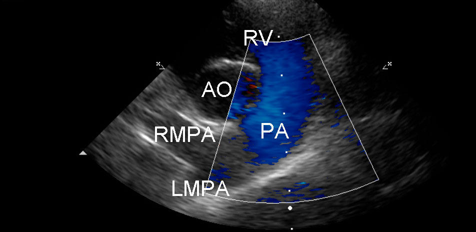 Advanced Echocardiography Workshop